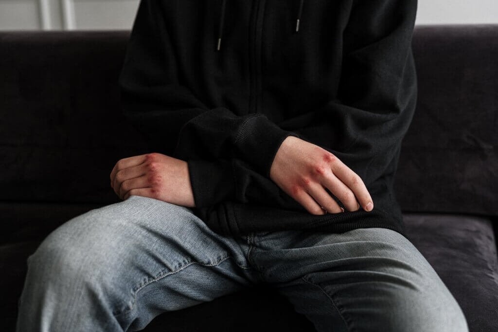 A nonverbal autistic child displaying aggression because of pain.